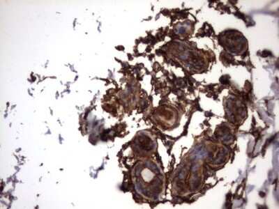 Immunohistochemistry: Cytokeratin 7 Antibody (OTI2A2) [NBP2-45578]