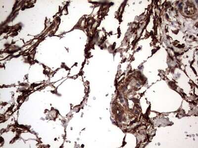 Immunohistochemistry: Cytokeratin 7 Antibody (OTI2A2) [NBP2-45578]