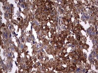 Immunohistochemistry: Cytokeratin 7 Antibody (OTI2A2) [NBP2-45578]