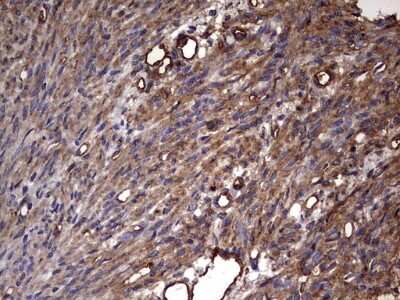 Immunohistochemistry: Cytokeratin 7 Antibody (OTI2A2) [NBP2-45578]