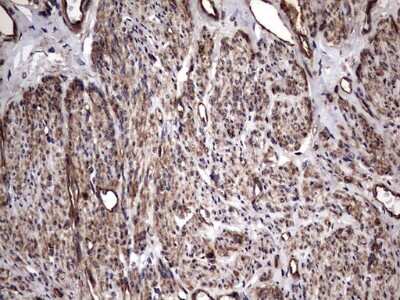 Immunohistochemistry: Cytokeratin 7 Antibody (OTI2A2) [NBP2-45578]