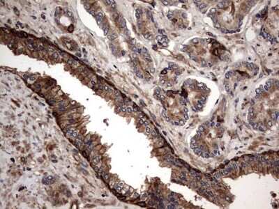 Immunohistochemistry: Cytokeratin 7 Antibody (OTI2A2) [NBP2-45578]