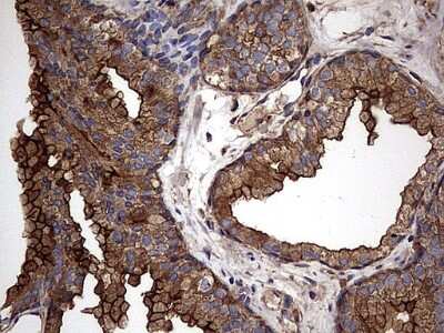 Immunohistochemistry: Cytokeratin 7 Antibody (OTI2A2) [NBP2-45578]