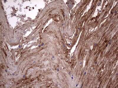 Immunohistochemistry: Cytokeratin 7 Antibody (OTI2A2) [NBP2-45578]