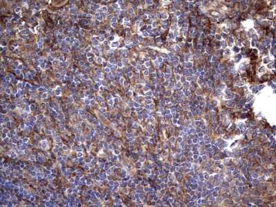 Immunohistochemistry: Cytokeratin 7 Antibody (OTI2A2) [NBP2-45578]