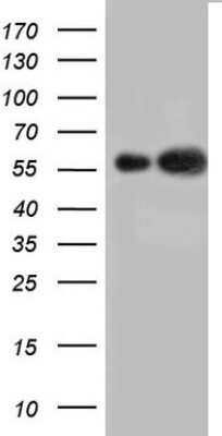 Western Blot: Cytokeratin 7 Antibody (OTI2A2) [NBP2-45578]