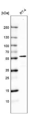 Western Blot: Cytokeratin 7 Antibody (CL8723) [NBP2-88918]