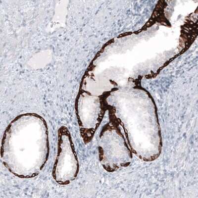 Immunohistochemistry-Paraffin: Cytokeratin 7 Antibody (CL8725) [NBP2-88919]