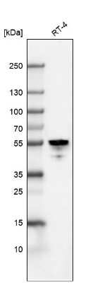 Western Blot: Cytokeratin 7 Antibody (CL8725) [NBP2-88919]
