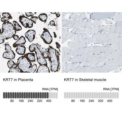 Immunohistochemistry-Paraffin: Cytokeratin 7 Antibody [NBP1-88080]