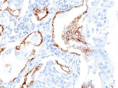 Immunohistochemistry-Paraffin: Cytokeratin 7 Antibody (K72.7) - Azide and BSA Free [NBP2-47941]