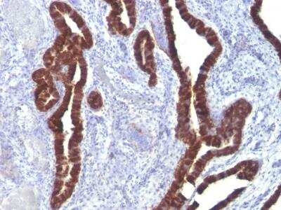 Immunohistochemistry-Paraffin: Cytokeratin 7 Antibody (K72.7) - Azide and BSA Free [NBP2-47941]