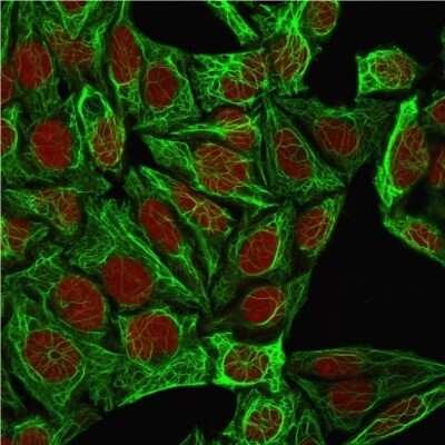 Immunocytochemistry/ Immunofluorescence: Cytokeratin 7 Antibody (K72.7) [NBP2-44816]