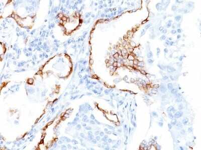 Immunohistochemistry-Paraffin: Cytokeratin 7 Antibody (K72.7) [NBP2-44816]