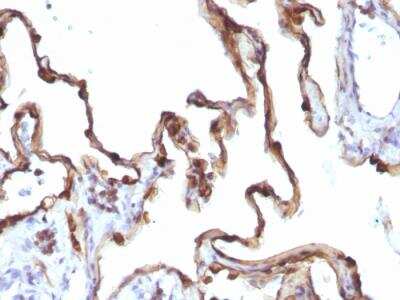 Immunohistochemistry-Paraffin: Cytokeratin 7 Antibody (KRT7/1198) - Azide and BSA Free [NBP2-47944]