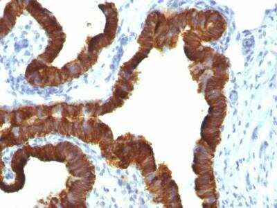 Immunohistochemistry-Paraffin: Cytokeratin 7 Antibody (KRT7/1198) - Azide and BSA Free [NBP2-47944]
