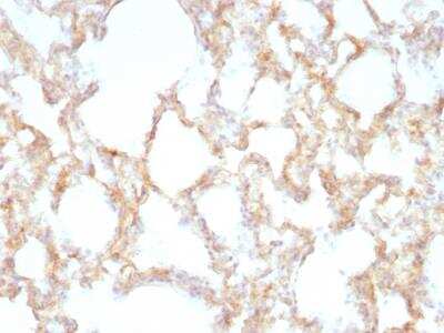 Immunohistochemistry-Paraffin: Cytokeratin 7 Antibody (KRT7/1198) - Azide and BSA Free [NBP2-47944]