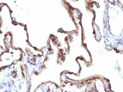 Immunohistochemistry-Paraffin: Cytokeratin 7 Antibody (KRT7/1198) [NBP2-44820]