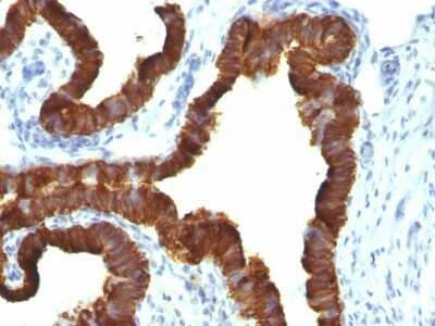 Immunohistochemistry-Paraffin: Cytokeratin 7 Antibody (KRT7/1198) [NBP2-44820]