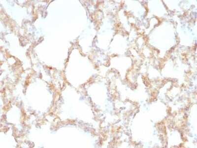 Immunohistochemistry-Paraffin: Cytokeratin 7 Antibody (KRT7/1198) [NBP2-44820]