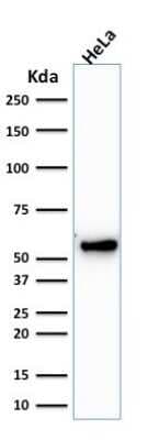Western Blot: Cytokeratin 7 Antibody (KRT7/1198) [NBP2-44820]