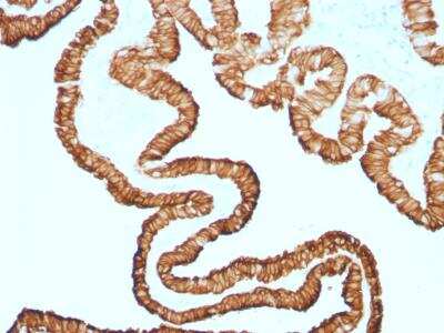 Immunohistochemistry-Paraffin: Cytokeratin 7 Antibody (KRT7/1499R) [NBP2-49880]