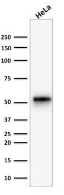 Western Blot: Cytokeratin 7 Antibody (KRT7/1499R) [NBP2-49880]