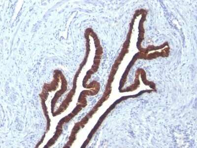 Immunohistochemistry-Paraffin: Cytokeratin 7 Antibody (KRT7/760 + KRT7/903) - IHC-Prediluted [NBP2-48143]