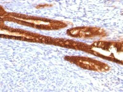 Immunohistochemistry-Paraffin: Cytokeratin 7 Antibody (KRT7/760 + KRT7/903) - IHC-Prediluted [NBP2-48143]