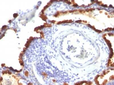 Immunohistochemistry-Paraffin: Cytokeratin 7 Antibody (KRT7/760 + KRT7/903) [NBP2-44818]