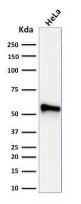 Western Blot: Cytokeratin 7 Antibody (KRT7/760 + KRT7/903) [NBP2-44818]