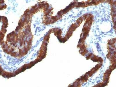 Immunohistochemistry-Paraffin: Cytokeratin 7 Antibody (KRT7/760 + OV-TL12/30) - Azide and BSA Free [NBP2-47943]