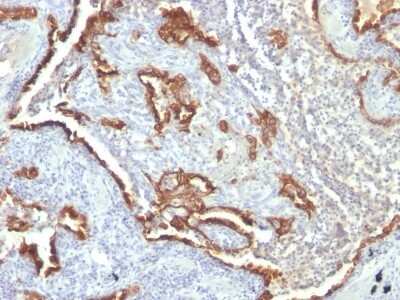 Immunohistochemistry-Paraffin: Cytokeratin 7 Antibody (KRT7/760 + OV-TL12/30) [NBP2-44819]