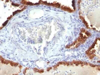 Immunohistochemistry-Paraffin: Cytokeratin 7 Antibody (KRT7/760) - IHC-Prediluted [NBP2-48140]
