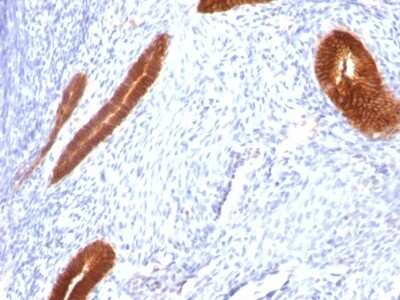 Immunohistochemistry-Paraffin: Cytokeratin 7 Antibody (KRT7/760) [NBP2-44813]