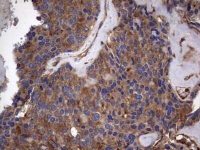 Immunohistochemistry: Cytokeratin 7 Antibody (OTI2A2) - Azide and BSA Free [NBP2-71080]