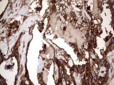 Immunohistochemistry: Cytokeratin 7 Antibody (OTI2A2) - Azide and BSA Free [NBP2-71080]