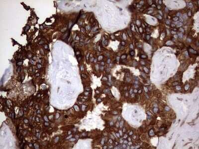 Immunohistochemistry: Cytokeratin 7 Antibody (OTI2A2) - Azide and BSA Free [NBP2-71080]
