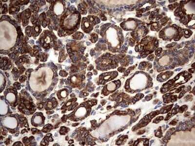 Immunohistochemistry: Cytokeratin 7 Antibody (OTI2A2) - Azide and BSA Free [NBP2-71080]