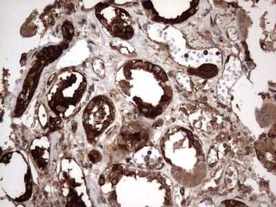 Immunohistochemistry: Cytokeratin 7 Antibody (OTI2A2) - Azide and BSA Free [NBP2-71080]