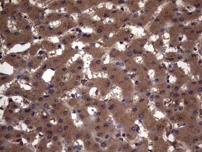 Immunohistochemistry: Cytokeratin 7 Antibody (OTI2A2) - Azide and BSA Free [NBP2-71080]