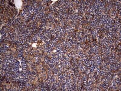 Immunohistochemistry: Cytokeratin 7 Antibody (OTI2A2) - Azide and BSA Free [NBP2-71080]