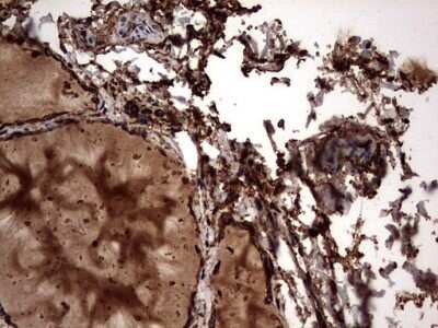 Immunohistochemistry: Cytokeratin 7 Antibody (OTI2A2) - Azide and BSA Free [NBP2-71080]