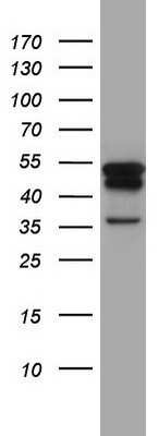 Western Blot: Cytokeratin 7 Antibody (OTI2A2)Azide and BSA Free [NBP2-71080]