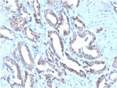 Immunohistochemistry-Paraffin: Cytokeratin 7 Antibody (OV-TL12/30) - Azide and BSA Free [NBP2-47940]