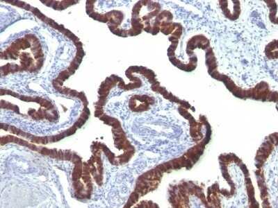 Immunohistochemistry-Paraffin: Cytokeratin 7 Antibody (OV-TL12/30) - IHC-Prediluted [NBP2-48115]