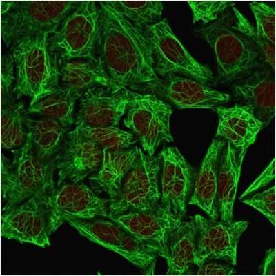 Immunocytochemistry/ Immunofluorescence: Cytokeratin 7 Antibody (OV-TL12/30) [NBP2-44814]