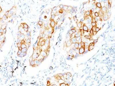 Immunohistochemistry-Paraffin: Cytokeratin 7 Antibody (OV-TL12/30) [NBP2-44814]