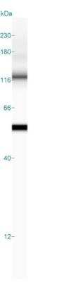 Simple Western: Cytokeratin 7 Antibody (OV-TL12/30) [NBP2-44814]