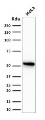 Western Blot: Cytokeratin 7 Antibody (OV-TL12/30) [NBP2-44814]